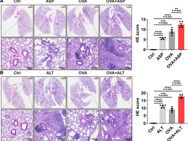 Fungal–allergen dual exposure amplifies airway inflammation. Representative H&E-stained lung sections from control, ASP-only, OVA-only, and OVA + ASP mice (A) and from control, ALT-only, OVA-only, and OVA + ALT mice (B) show increased inflammatory cell infiltration and architectural distortion in OVA+fungus groups. Scale bars, 1 mm and 100 μm. Inflammation severity was assessed by blind semiquantitative scoring. Statistics: one-way ANOVA with Tukey’s post hoc test. Abbreviations: OVA, ovalbumin; ASP, Asperg