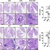 Fungal–allergen dual exposure amplifies airway inflammation. Representative H&E-stained lung sections from control, ASP-only, OVA-only, and OVA + ASP mice (A) and from control, ALT-only, OVA-only, and OVA + ALT mice (B) show increased inflammatory cell infiltration and architectural distortion in OVA+fungus groups. Scale bars, 1 mm and 100 μm. Inflammation severity was assessed by blind semiquantitative scoring. Statistics: one-way ANOVA with Tukey’s post hoc test. Abbreviations: OVA, ovalbumin; ASP, Asperg